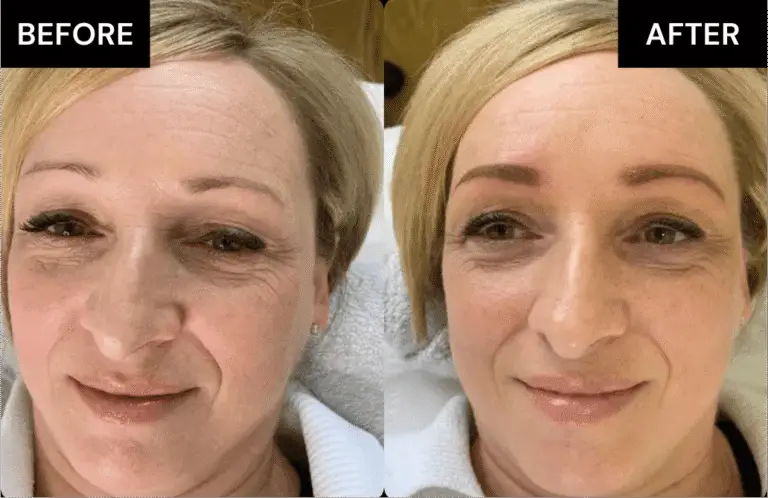 Before and after brows Treatment 1