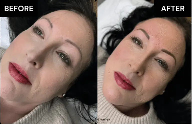 Before and after brows Treatment 1