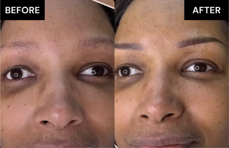 Before and after brows Treatment 1