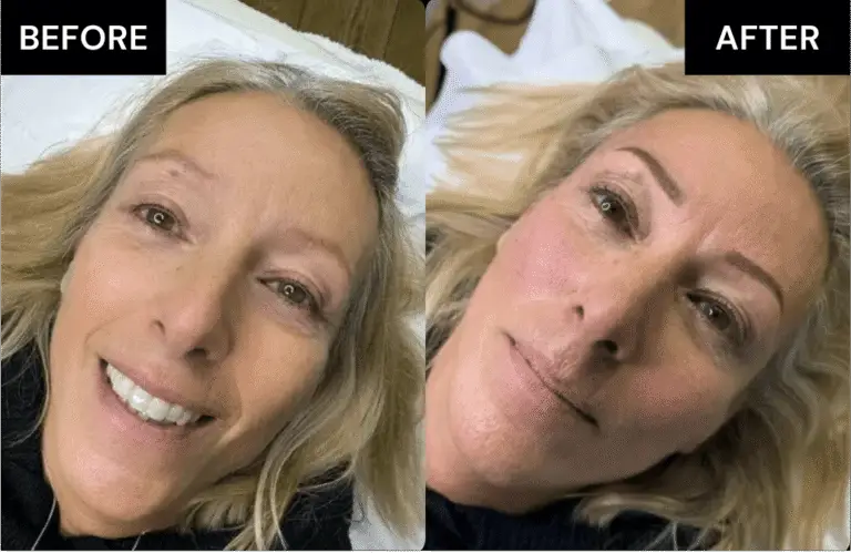 Before and after brows Treatment 1