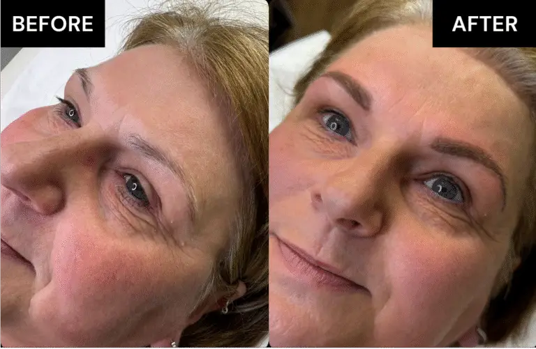 Before and after brows Treatment 1